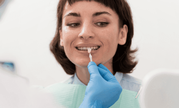 Les facettes dentaires en composite : innovation esthétique pour un sourire radieux