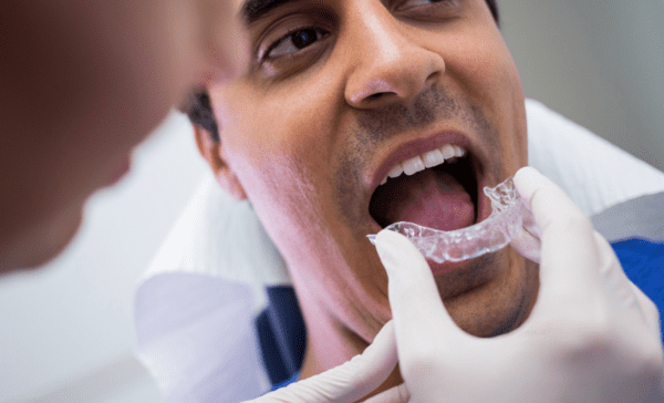Les types de correction dentaire dans les Traitements Orthodontie