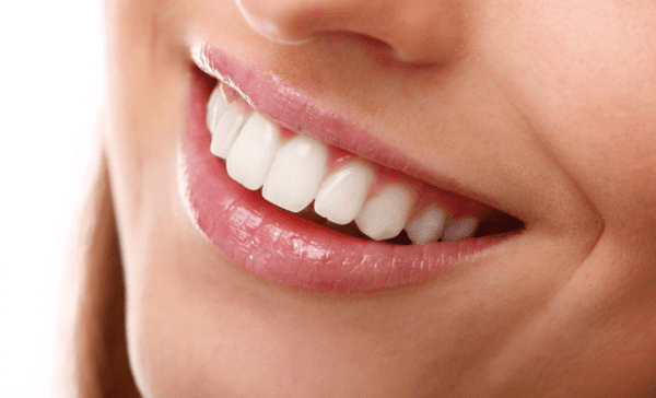 Orthodontie lingual : La solution discrète